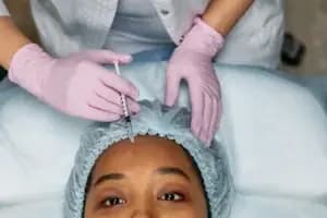 Botox for Migraines Chronic Treatment